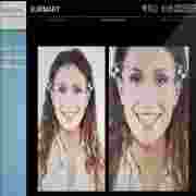 Digital Smile System